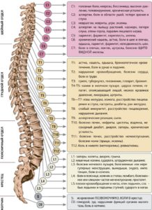 болит поясница +что делать,Спина, болезни, боли